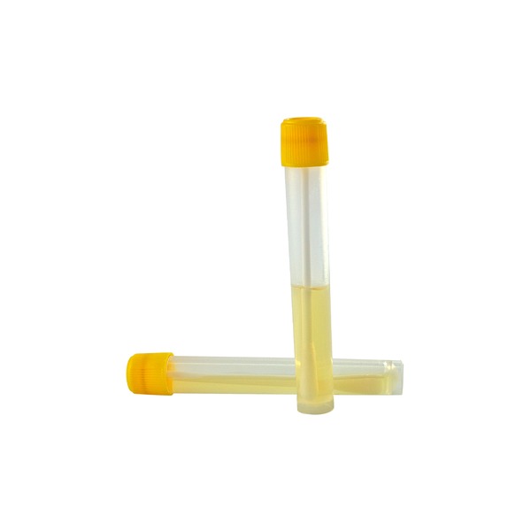 GVS Liquid Media Vials — Sıvı Besiyeri Vialleri